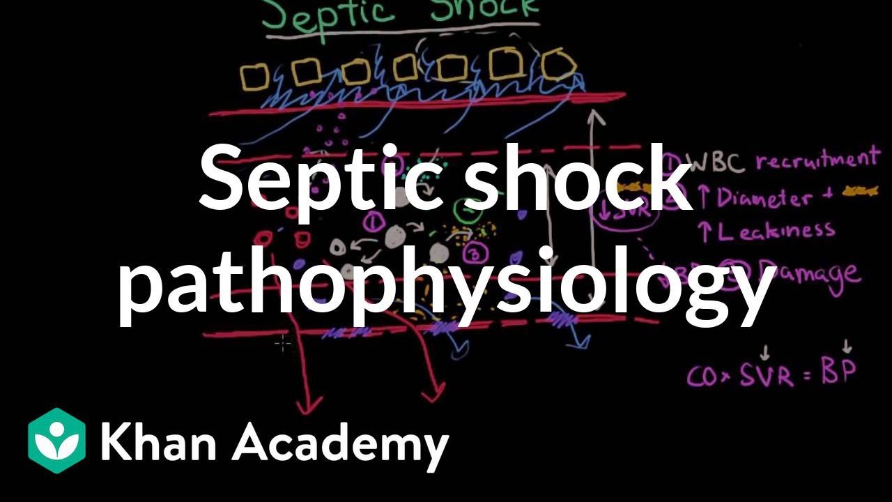 Septic Shock – Pathophysiology And Symptoms